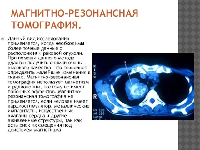 МАГНИТНО-РЕЗОНАНСНАЯ ТОМОГРАФИЯ. Данный вид исследования применяется, когда необходимы более точные данные