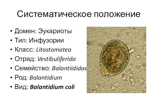 Систематическое положение Домен: Эукариоты Тип: Инфузории Класс: Litostomatea Отряд: Vestibuliferida Семейство: