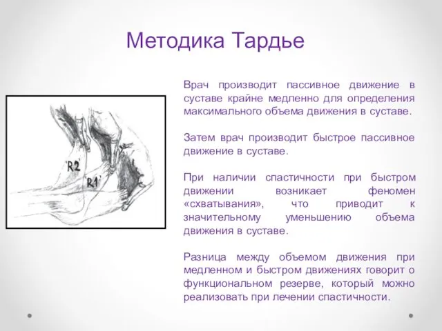 Методика Тардье Врач производит пассивное движение в суставе крайне медленно для