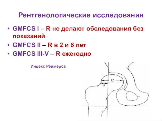 Рентгенологические исследования GMFCS I – R не делают обследования без показаний