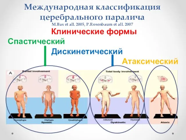 Международная классификация церебрального паралича M.Bax et all. 2005, P.Rosenbaum et all.