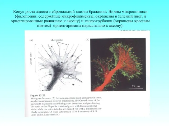 Конус роста аксона нейрональной клетки бражника. Видны микрошипики (филоподии, содержащие микрофиламенты,