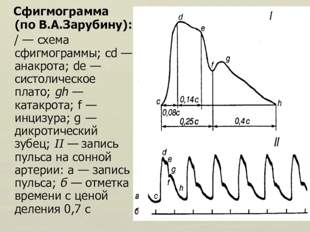 Сфигмограмма (по В.А.Зарубину): / — схема сфигмограммы; cd — анакрота; de