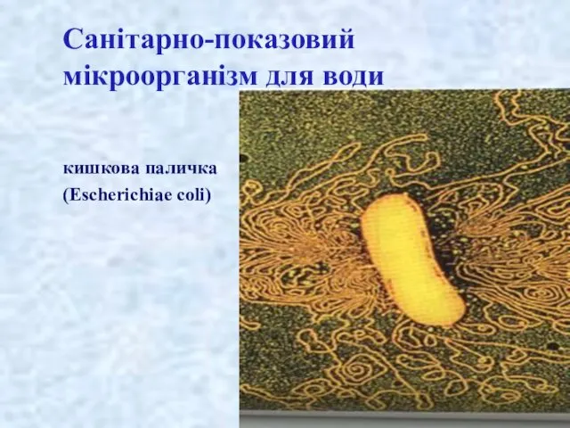 Санітарно-показовий мікроорганізм для води кишкова паличка (Escherichiae coli)