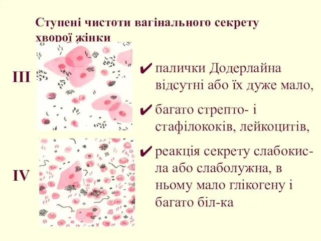 Ступені чистоти вагінального секрету хворої жінки палички Додерлайна відсутні або їх