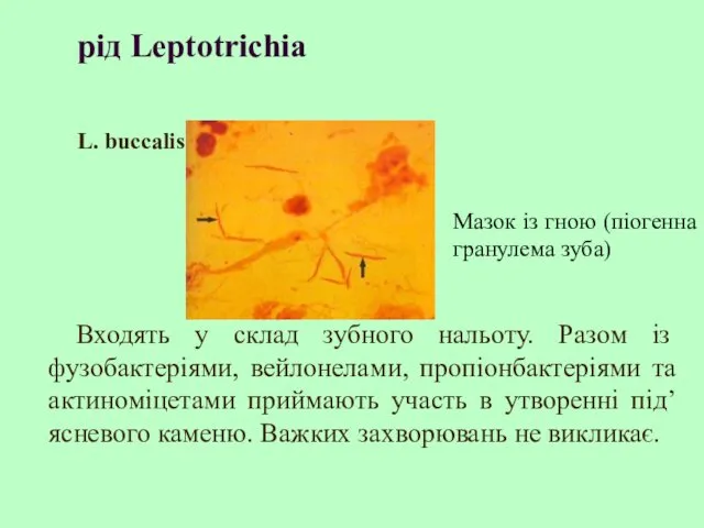 рід Leptotrichia L. buccalis Входять у склад зубного нальоту. Разом із