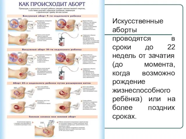 Искусственные аборты проводятся в сроки до 22 недель от зачатия (до