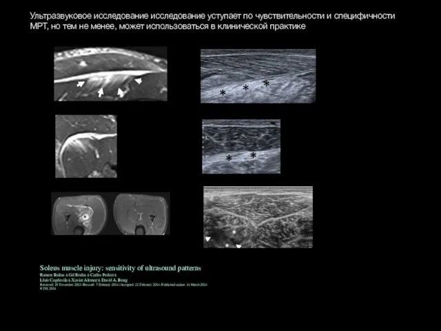 Ультразвуковое исследование исследование уступает по чувствительности и специфичности МРТ, но тем