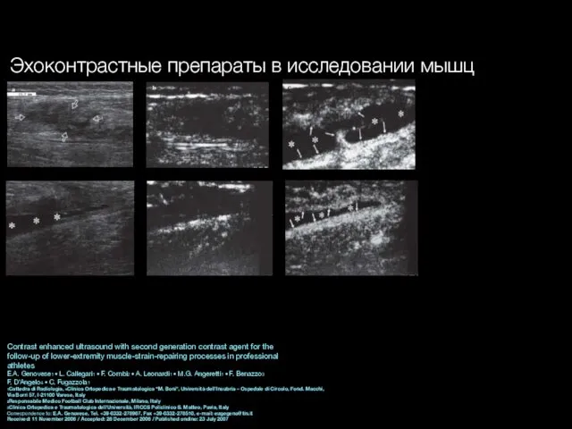 Contrast enhanced ultrasound with second generation contrast agent for the follow-up