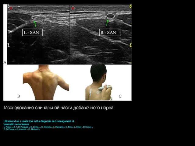 Ultrasound as a useful tool in the diagnosis and management of