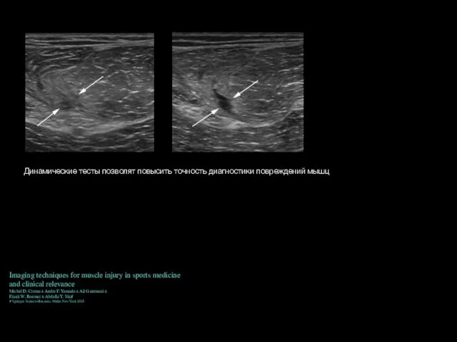Динамические тесты позволят повысить точность диагностики повреждений мышц Imaging techniques for
