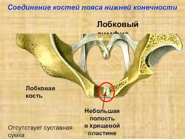 Лобковый симфиз Лобковая кость Небольшая полость в хрящевой пластине Отсутствует суставная