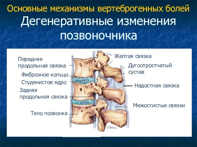 Передняя продольная связка Фиброзное кольцо Студенистое ядро Задняя продольная связка Тело