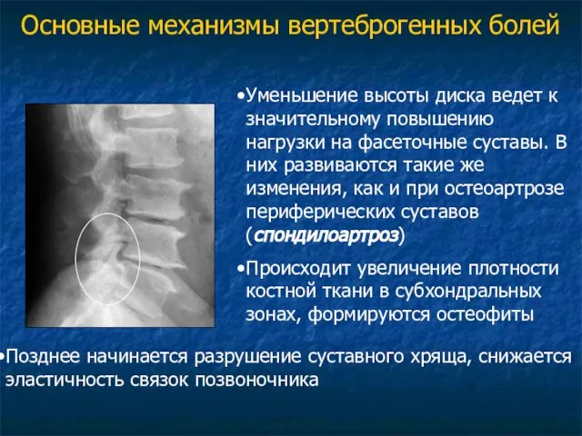 Позднее начинается разрушение суставного хряща, снижается эластичность связок позвоночника Уменьшение высоты