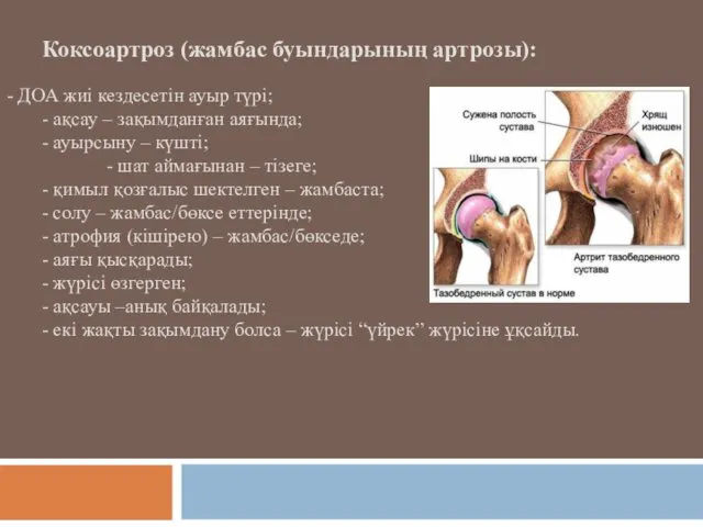 Коксоартроз (жамбас буындарының артрозы): - ДОА жиі кездесетін ауыр түрі; -