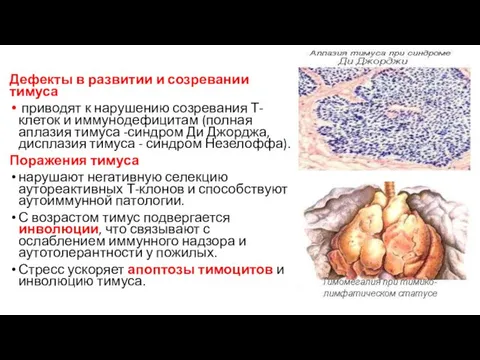 Дефекты в развитии и созревании тимуса приводят к нарушению созревания Т-клеток