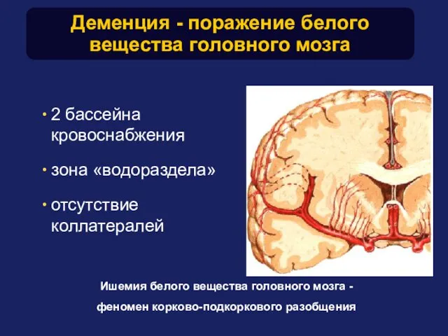 Деменция - поражение белого вещества головного мозга 2 бассейна кровоснабжения зона