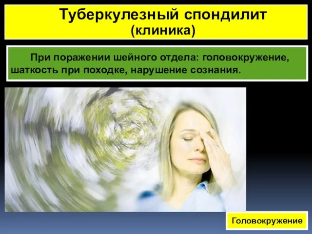 При поражении шейного отдела: головокружение, шаткость при походке, нарушение сознания. Головокружение Туберкулезный спондилит (клиника)