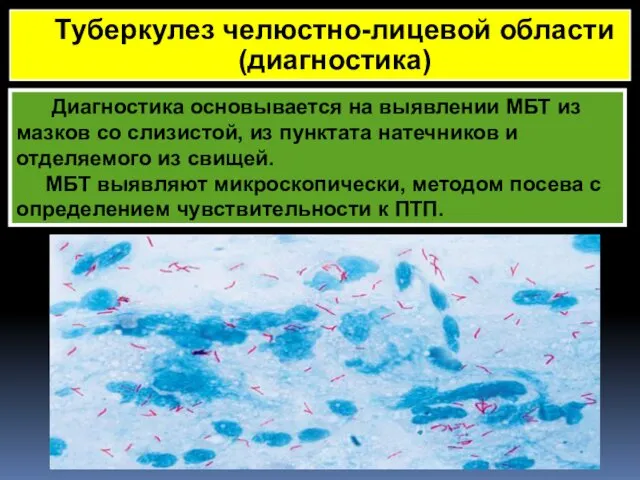 Диагностика основывается на выявлении МБТ из мазков со слизистой, из пунктата