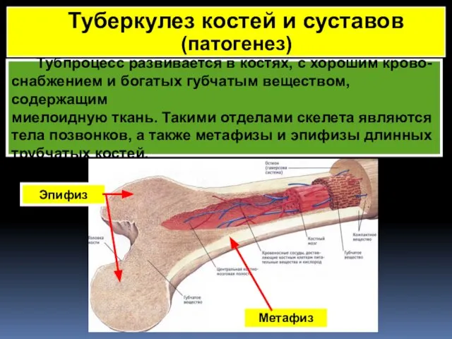 Тубпроцесс развивается в костях, с хорошим крово- снабжением и богатых губчатым