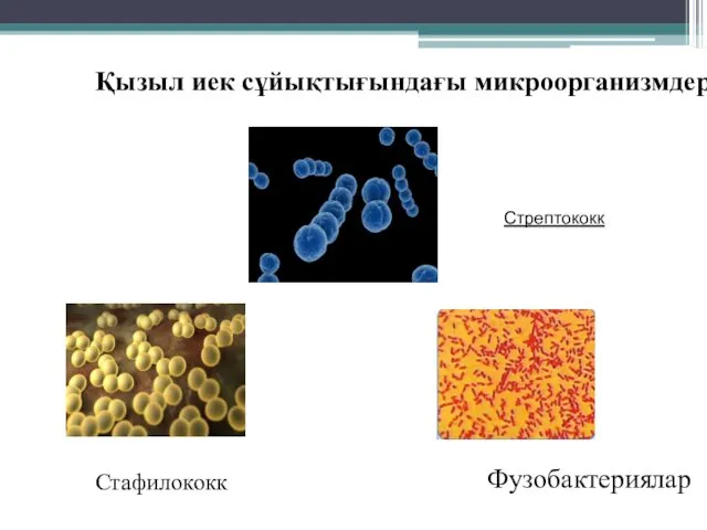 Қызыл иек сұйықтығындағы микроорганизмдер Стрептококк Стафилококк Фузобактериялар