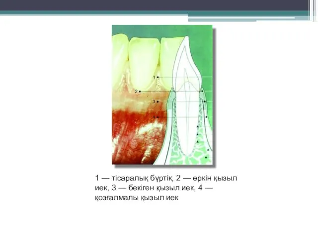 1 — тісаралық бүртік, 2 — еркін қызыл иек, 3 —