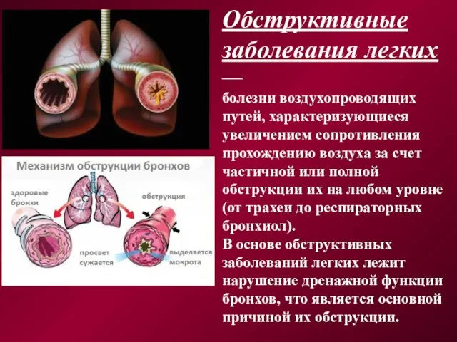 Обструктивные заболевания легких — болезни воздухопроводящих путей, характеризующиеся увеличением сопротивления прохождению