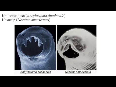 Кривоголовка (Ancylostoma duodenale) Некатор (Necator americanus)