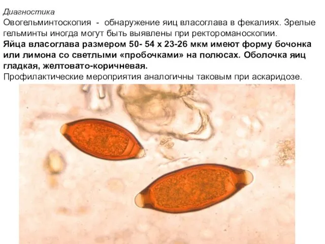 Диагностика Овогельминтоскопия - обнаружение яиц власоглава в фекалиях. Зрелые гельминты иногда