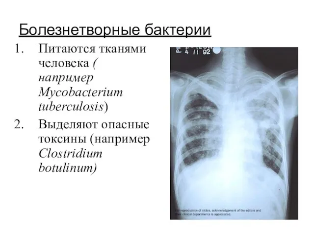 Болезнетворные бактерии Питаются тканями человека ( например Mycobacterium tuberculosis) Выделяют опасные токсины (например Clostridium botulinum)