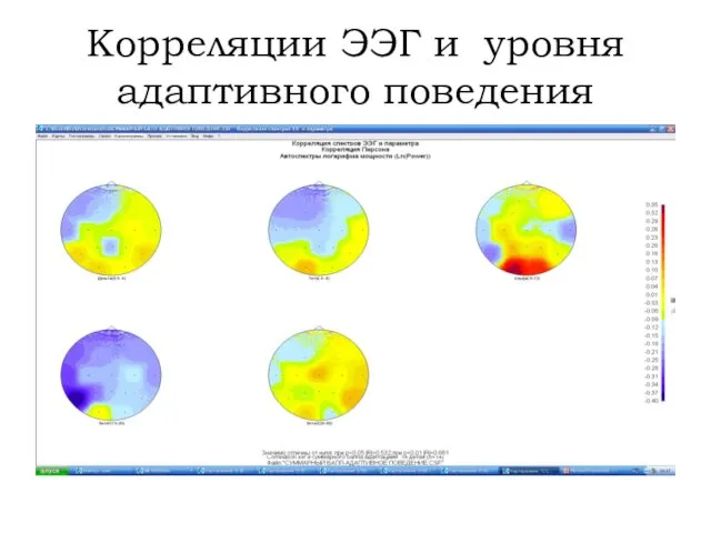 Корреляции ЭЭГ и уровня адаптивного поведения