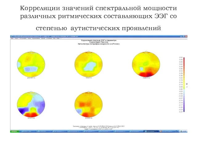 Корреляции значений спектральной мощности различных ритмических составляющих ЭЭГ со степенью аутистических проявлений