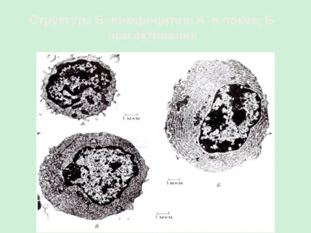Структура В -лимфоцитов: А -в покое; Б- при активации