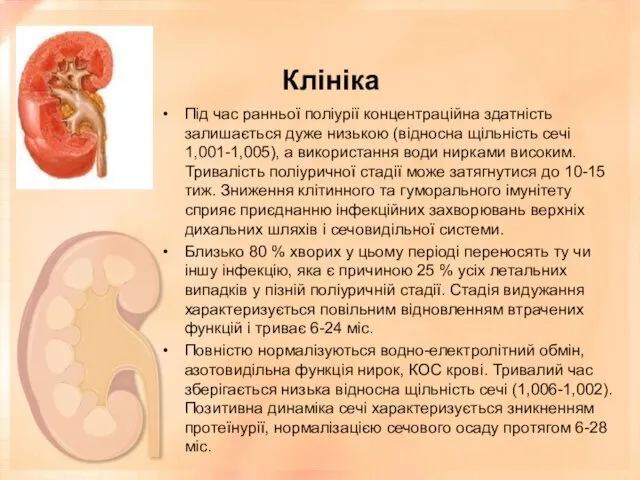 Клініка Під час ранньої поліурії концентраційна здатність залишається дуже низькою (відносна