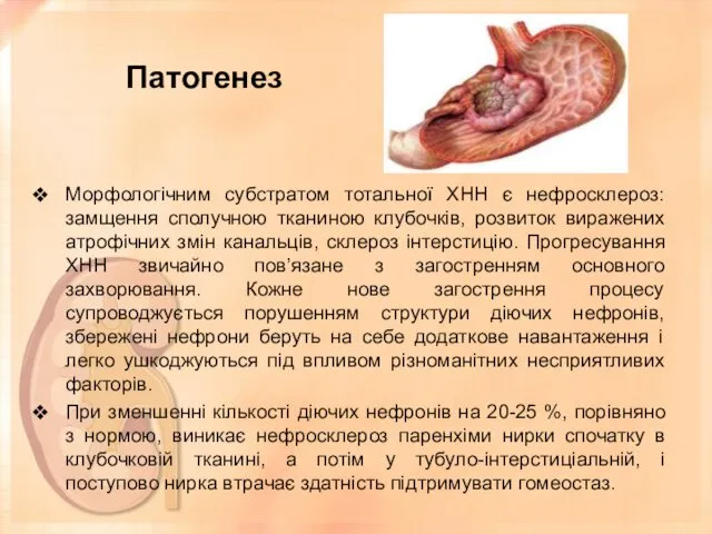 Патогенез Морфологічним субстратом тотальної ХНН є нефросклероз: замщення сполучною тканиною клубочків,