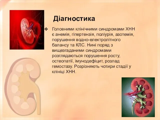 Діагностика Головними клінічними синдромами ХНН є анемія, гіпертензія, поліурія, азотемія, порушення