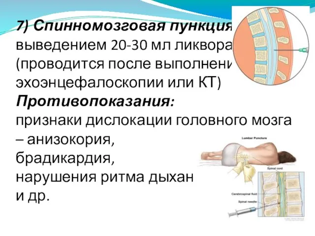 7) Спинномозговая пункция с выведением 20-30 мл ликвора (проводится после выполнения