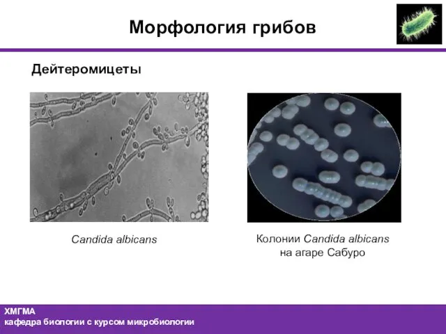 Морфология грибов Дейтеромицеты Candida albicans Колонии Candida albicans на агаре Сабуро