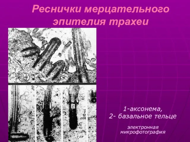 Реснички мерцательного эпителия трахеи 1-аксонема, 2- базальное тельце электронная микрофотография