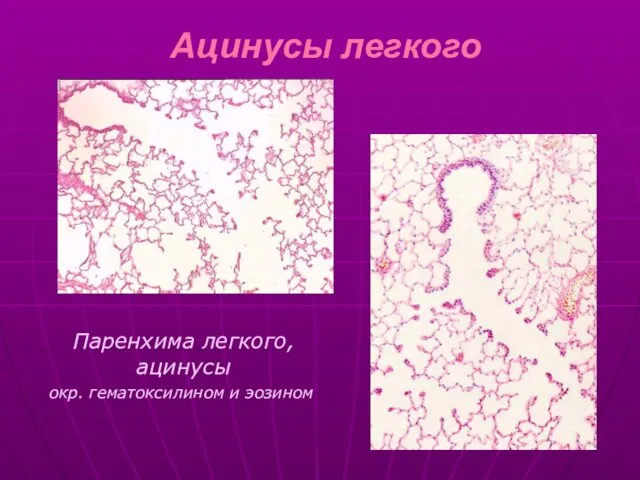 Ацинусы легкого Паренхима легкого, ацинусы окр. гематоксилином и эозином