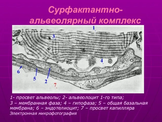 Сурфактантно-альвеолярный комплекс 1- просвет альвеолы; 2- альвеолоцит 1-го типа; 3 –