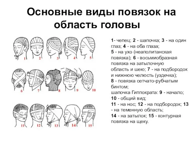 Основные виды повязок на область головы 1- чепец; 2 - шапочка;