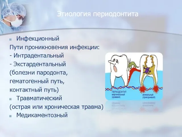 Этиология периодонтита Инфекционный Пути проникновения инфекции: - Интрадентальный - Экстардентальный (болезни