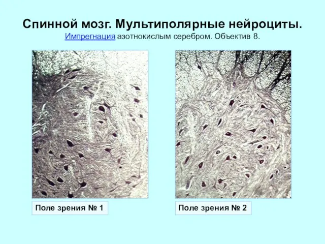 Спинной мозг. Мультиполярные нейроциты. Импрегнация азотнокислым серебром. Объектив 8. Поле зрения