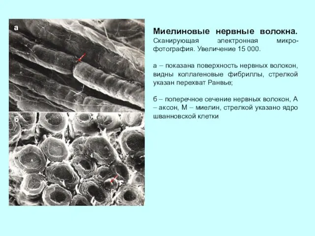 Миелиновые нервные волокна. Сканирующая электронная микро-фотография. Увеличение 15 000. а –