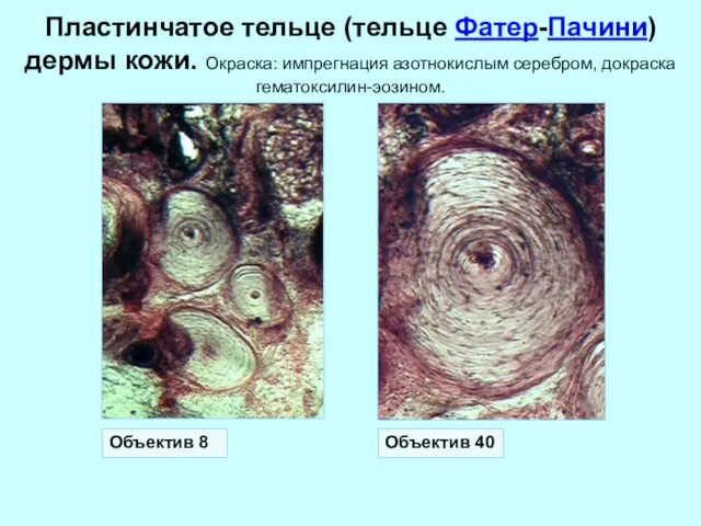 Объектив 40 Объектив 8 Пластинчатое тельце (тельце Фатер-Пачини) дермы кожи. Окраска: импрегнация азотнокислым серебром, докраска гематоксилин-эозином.