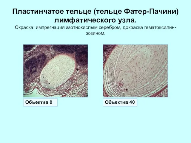 Пластинчатое тельце (тельце Фатер-Пачини) лимфатического узла. Окраска: импрегнация азотнокислым серебром, докраска гематоксилин-эозином. Объектив 40 Объектив 8