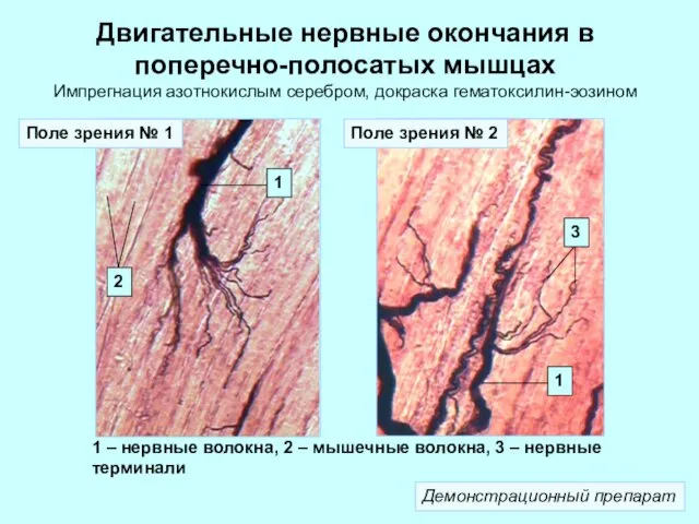 Двигательные нервные окончания в поперечно-полосатых мышцах Импрегнация азотнокислым серебром, докраска гематоксилин-эозином