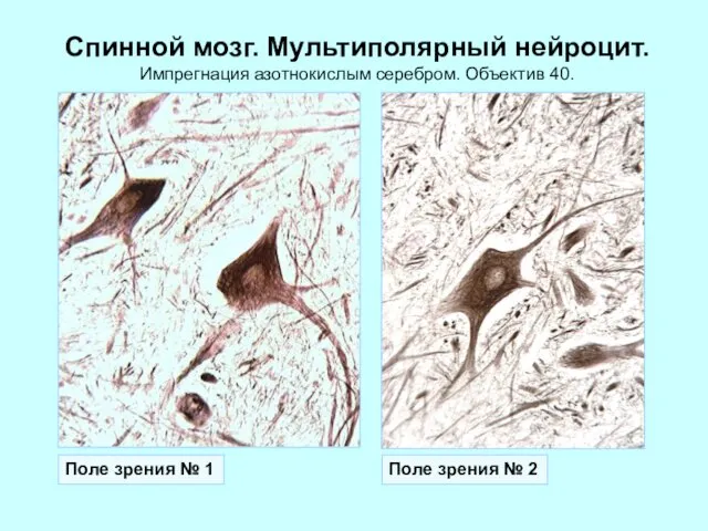 Спинной мозг. Мультиполярный нейроцит. Импрегнация азотнокислым серебром. Объектив 40. Поле зрения