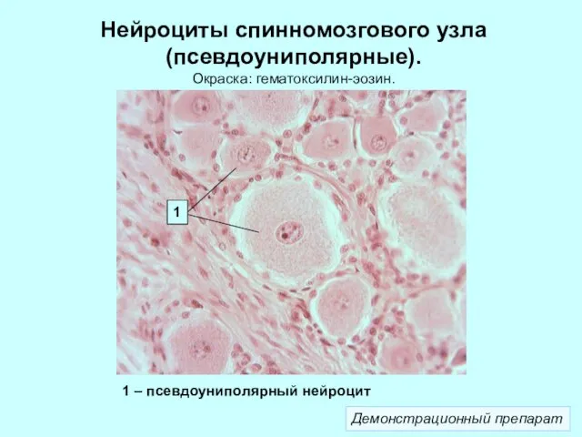 Нейроциты спинномозгового узла (псевдоуниполярные). Окраска: гематоксилин-эозин. Демонстрационный препарат 1 1 – псевдоуниполярный нейроцит